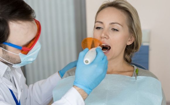 Dental Fillings | Tooth Colored Fillings